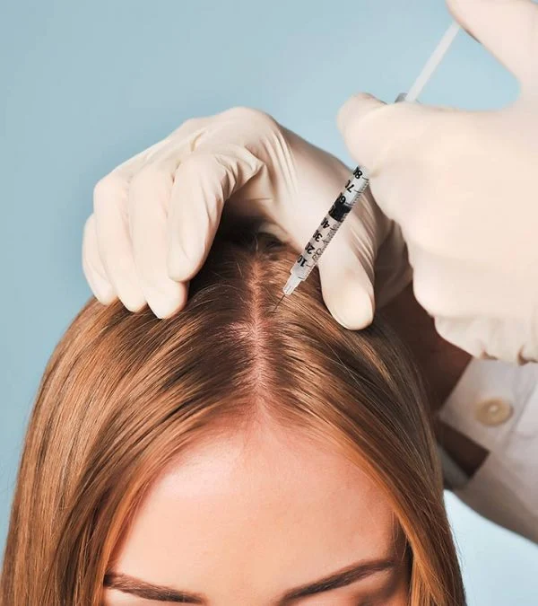Hair mesotherapy is an excellent way to control hair loss